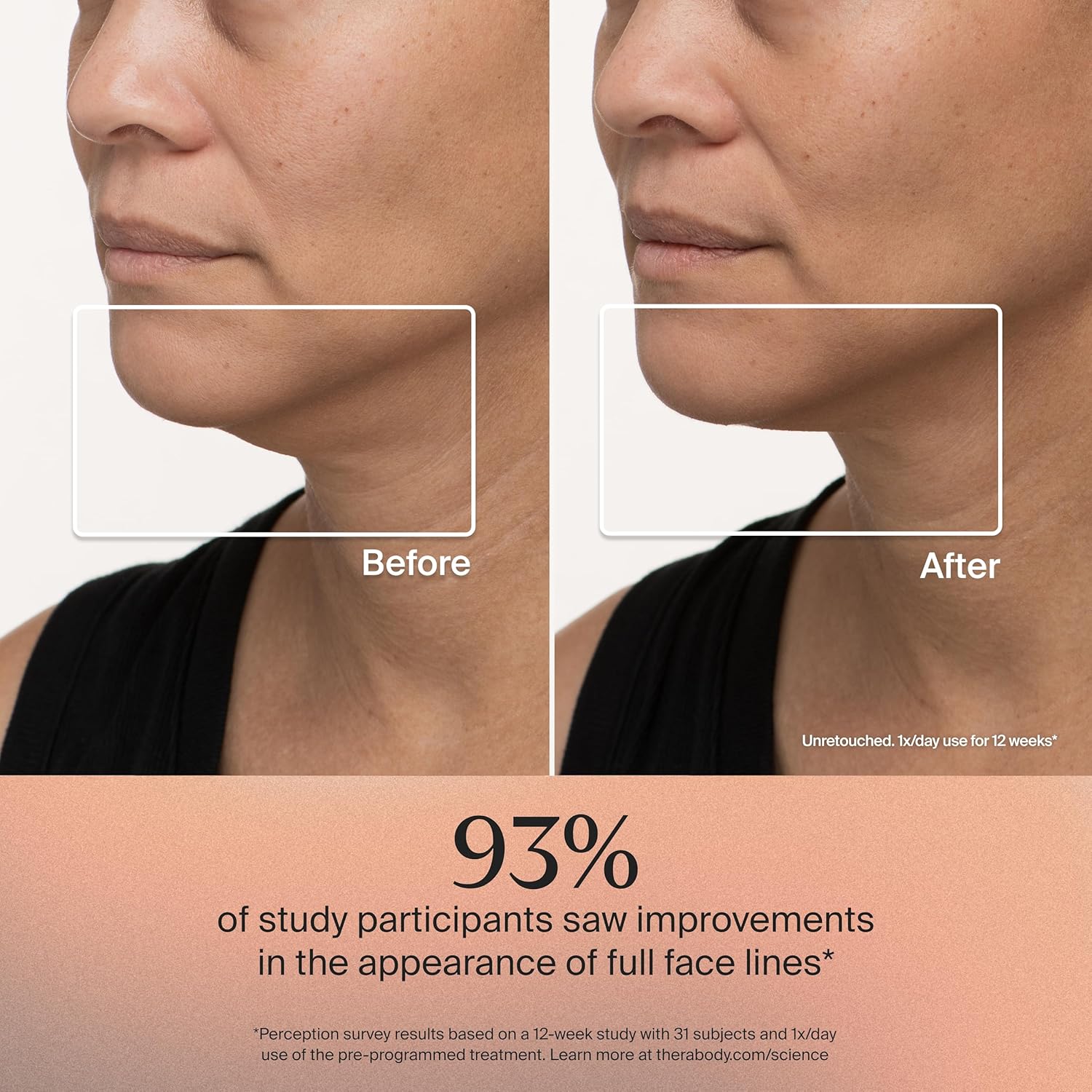 TheraFace Mask (FDA cleared LED skincare mask)