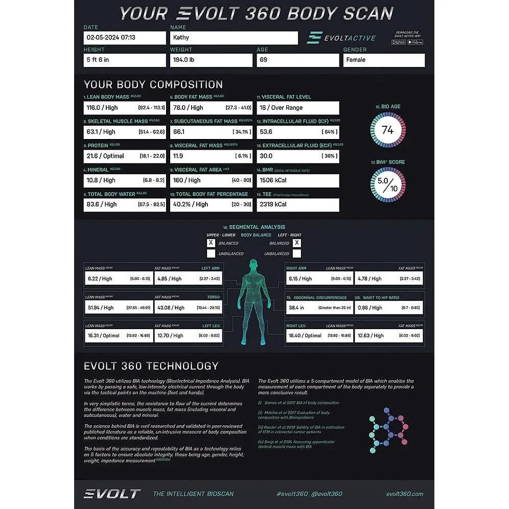 Evolt Intelligent 360 Body Scanner